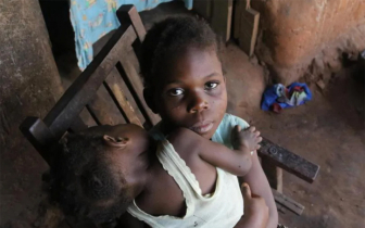 Malnutrition due to Covid-19 crisis can kill 168,000 children over next 2 years