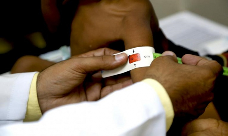 UNICEF estimates 10.4 ml children to suffer from acute malnutrition in 2021